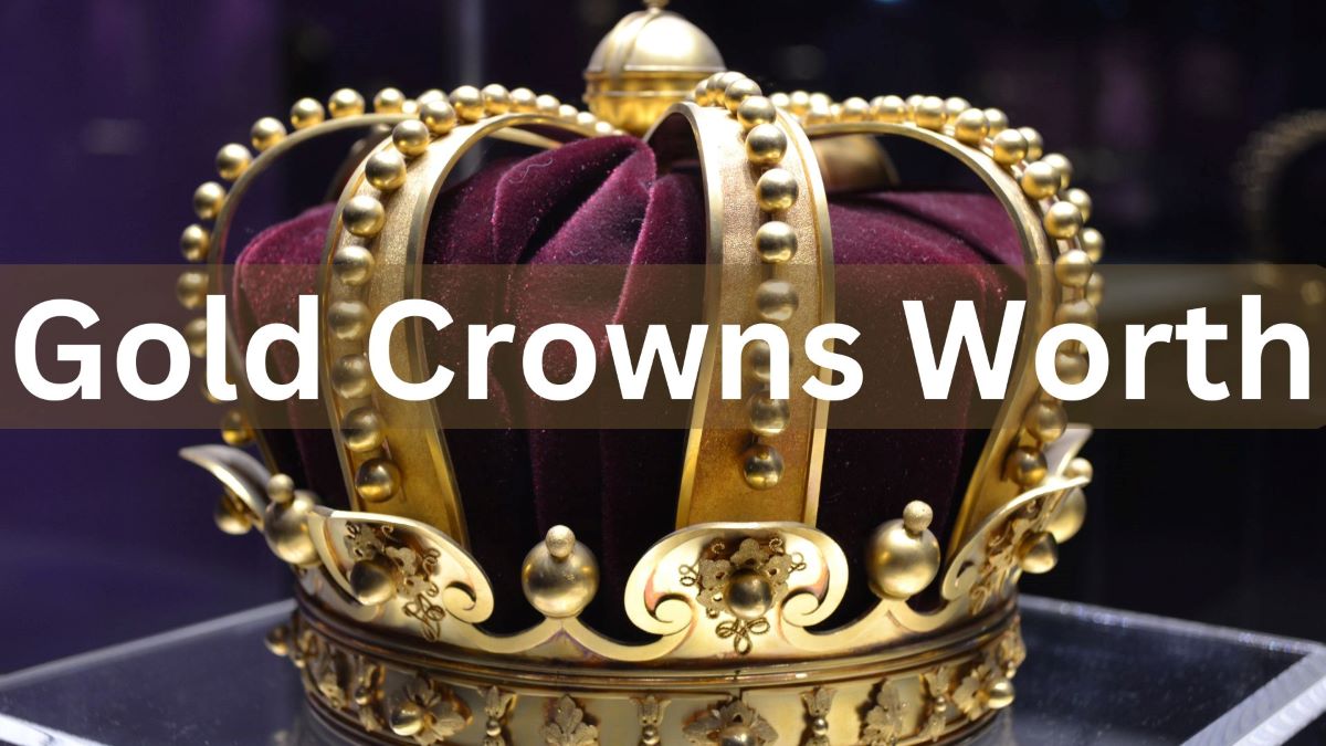Gold Crowns Worth